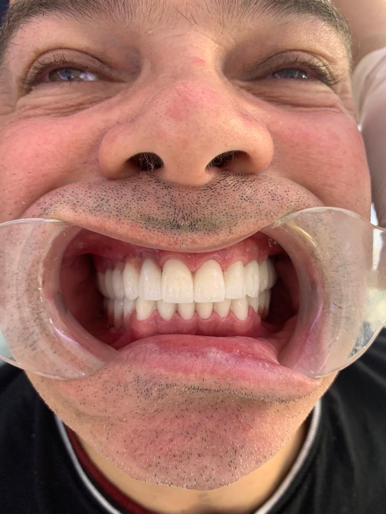 Dental